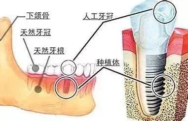 案例图片