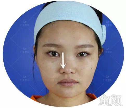 https://img.miyanlife.com/mnt/timg/180918/132139A03-5.jpg