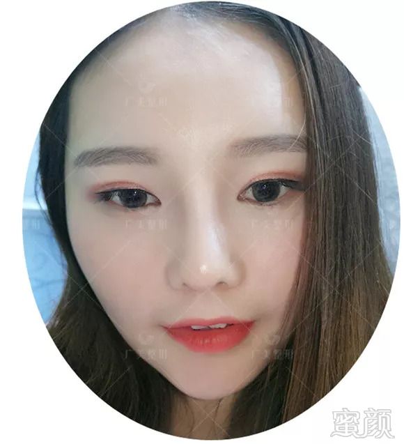 https://img.miyanlife.com/mnt/timg/180918/13213S628-2.jpg