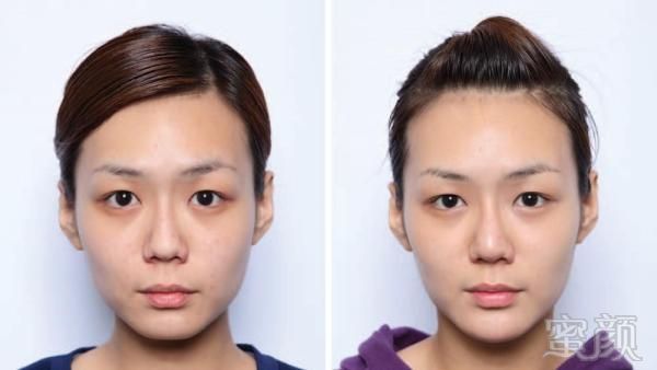 https://img.miyanlife.com/mnt/timg/180918/1J41I539-3.jpg 案例图片