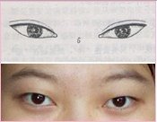 https://img.miyanlife.com/mnt/timg/180918/1K3093463-9.jpg 案例图片