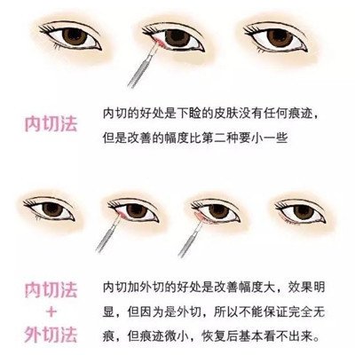 https://img.miyanlife.com/mnt/timg/180918/1K30G3T-5.jpg 案例图片