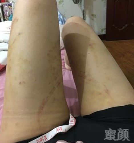 https://img.miyanlife.com/mnt/timg/180918/1KZT927-12.jpg