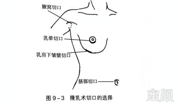 https://img.miyanlife.com/mnt/timg/180918/1P2554203-4.jpg