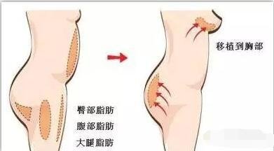 https://img.miyanlife.com/mnt/timg/180918/1P2561340-6.jpg