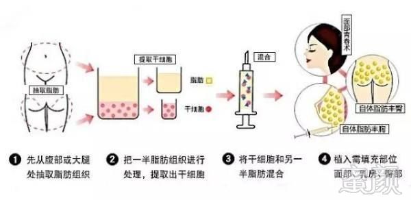 https://img.miyanlife.com/mnt/timg/180918/1P25MN4-7.jpg