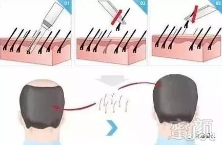 https://img.miyanlife.com/mnt/timg/180919/1120002242-1.jpg
