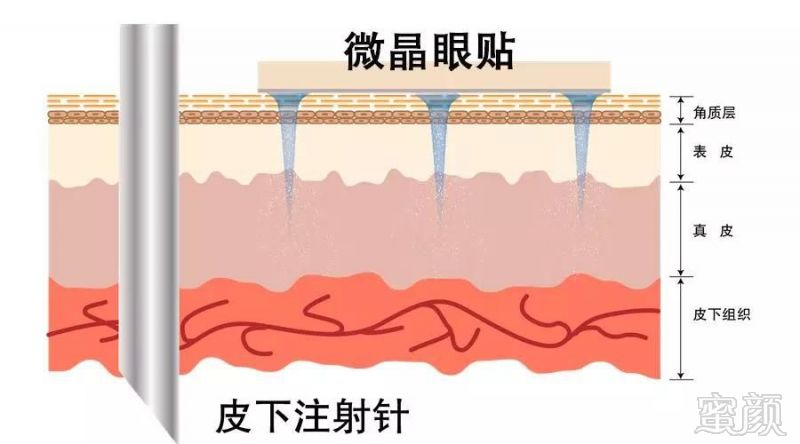 https://img.miyanlife.com/mnt/timg/180919/1120331J2-3.jpg