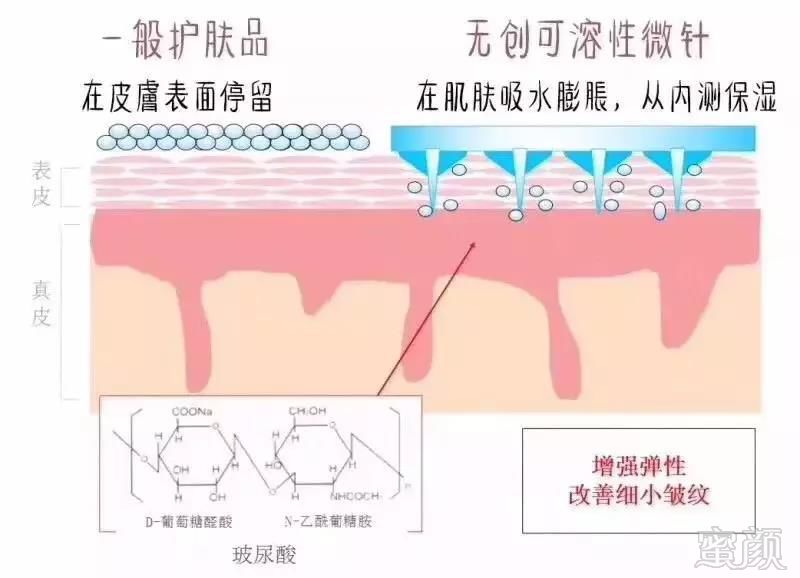 https://img.miyanlife.com/mnt/timg/180919/1120345E6-6.jpg