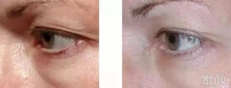 https://img.miyanlife.com/mnt/timg/180919/11221913T-8.jpg