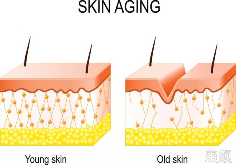 https://img.miyanlife.com/mnt/timg/180919/1122195047-6.jpg