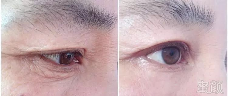 https://img.miyanlife.com/mnt/timg/180919/11222024V-9.jpg