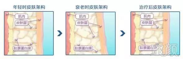 https://img.miyanlife.com/mnt/timg/180919/11240153Q-7.jpg