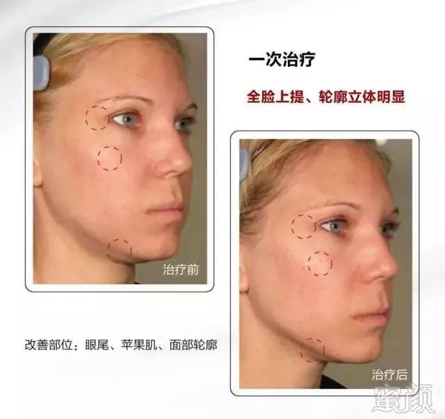 https://img.miyanlife.com/mnt/timg/180919/1124021U1-9.jpg