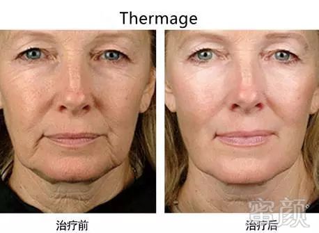 https://img.miyanlife.com/mnt/timg/180919/112402Cc-10.jpg