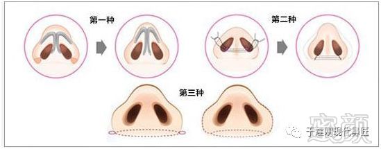 https://img.miyanlife.com/mnt/timg/180919/1124195C2-3.jpg