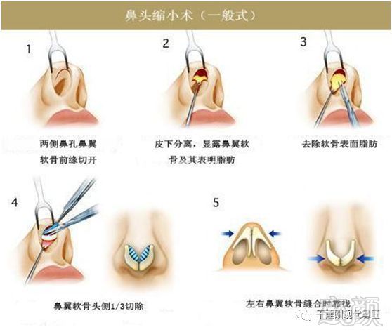 https://img.miyanlife.com/mnt/timg/180919/11241W0b-2.jpg