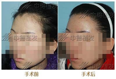 https://img.miyanlife.com/mnt/timg/180919/113K31030-3.jpg