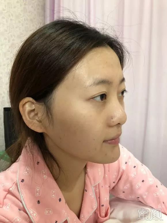 https://img.miyanlife.com/mnt/timg/180919/11545QF2-2.jpg
