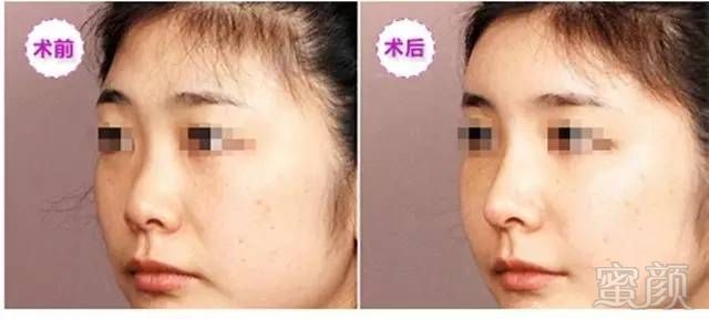 https://img.miyanlife.com/mnt/timg/180919/12231013I-6.jpg
