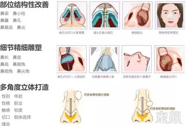 https://img.miyanlife.com/mnt/timg/180919/1223105046-5.jpg
