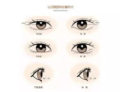 https://img.miyanlife.com/mnt/timg/180919/12422C125-8.jpg