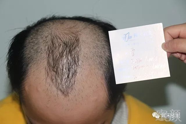 https://img.miyanlife.com/mnt/timg/180919/12524RZ1-2.jpg