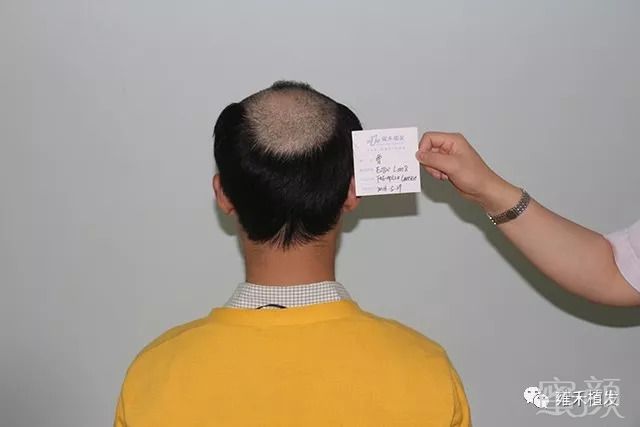 https://img.miyanlife.com/mnt/timg/180919/12524T552-3.jpg
