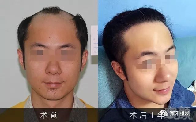 https://img.miyanlife.com/mnt/timg/180919/12524U958-0.jpg