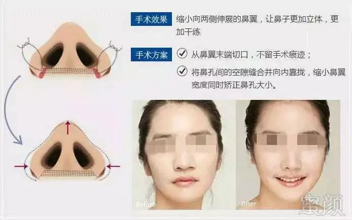 https://img.miyanlife.com/mnt/timg/180919/131RH929-5.jpg
