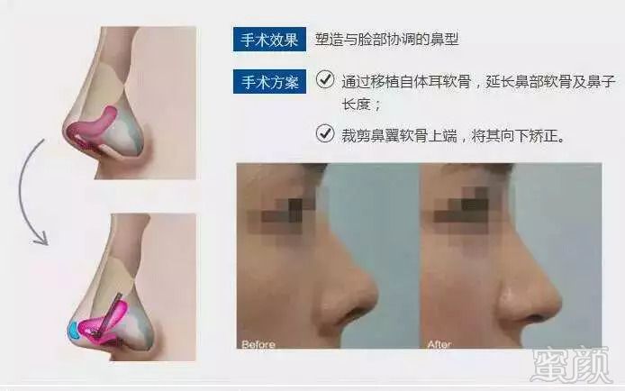 https://img.miyanlife.com/mnt/timg/180919/131RI1C-6.jpg