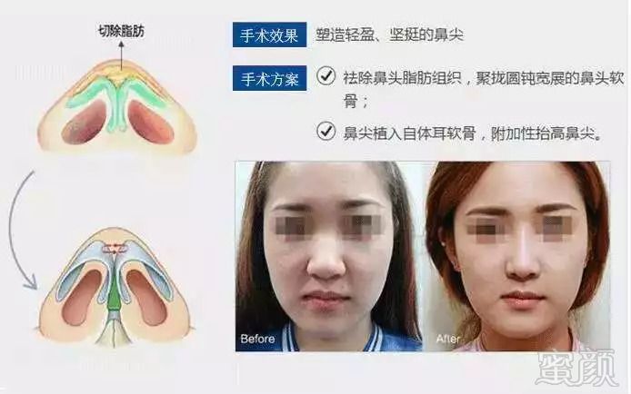 https://img.miyanlife.com/mnt/timg/180919/131RL605-4.jpg