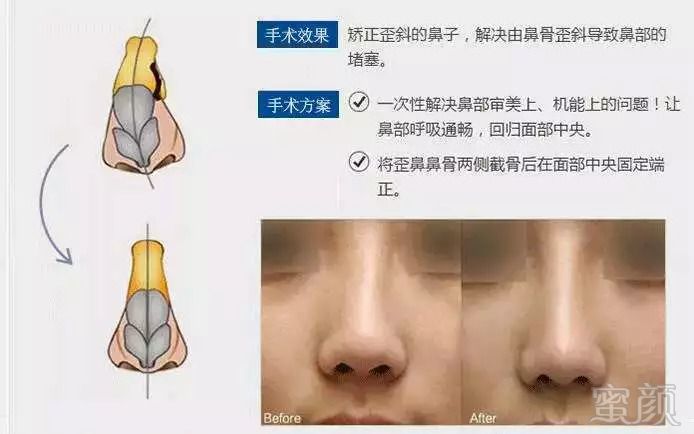 https://img.miyanlife.com/mnt/timg/180919/131RR5R-8.jpg