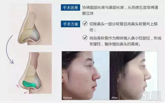 https://img.miyanlife.com/mnt/timg/180919/131RR5X-10.jpg