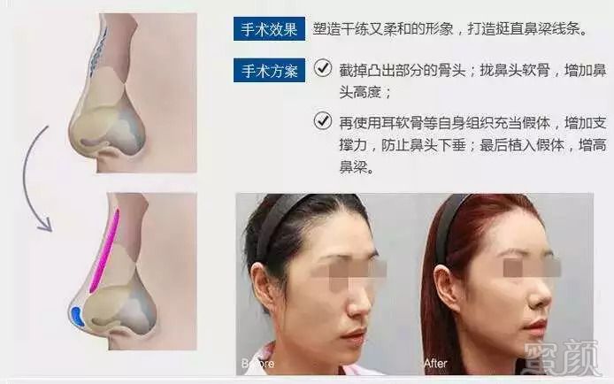 https://img.miyanlife.com/mnt/timg/180919/131RS236-7.jpg