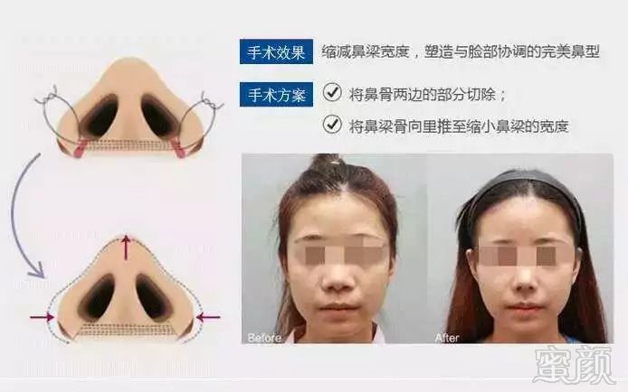 https://img.miyanlife.com/mnt/timg/180919/131RTT0-9.jpg