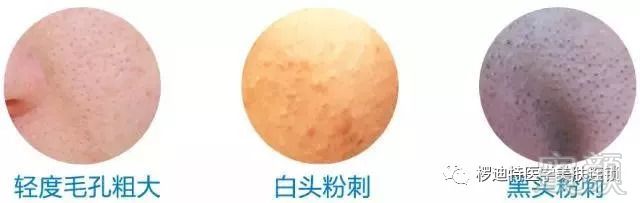https://img.miyanlife.com/mnt/timg/180920/1101241216-6.jpg