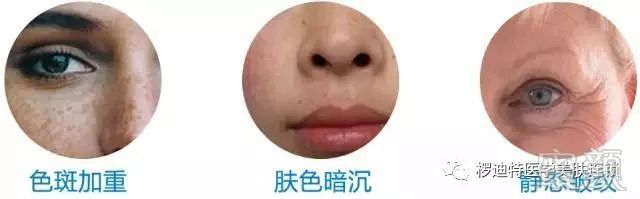https://img.miyanlife.com/mnt/timg/180920/1101241513-7.jpg