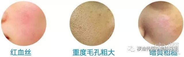 https://img.miyanlife.com/mnt/timg/180920/1101245322-5.jpg