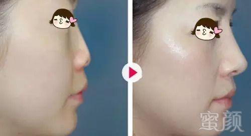 https://img.miyanlife.com/mnt/timg/180920/11013H0K-3.jpg