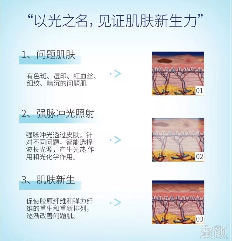 https://img.miyanlife.com/mnt/timg/180920/1105256294-3.jpg