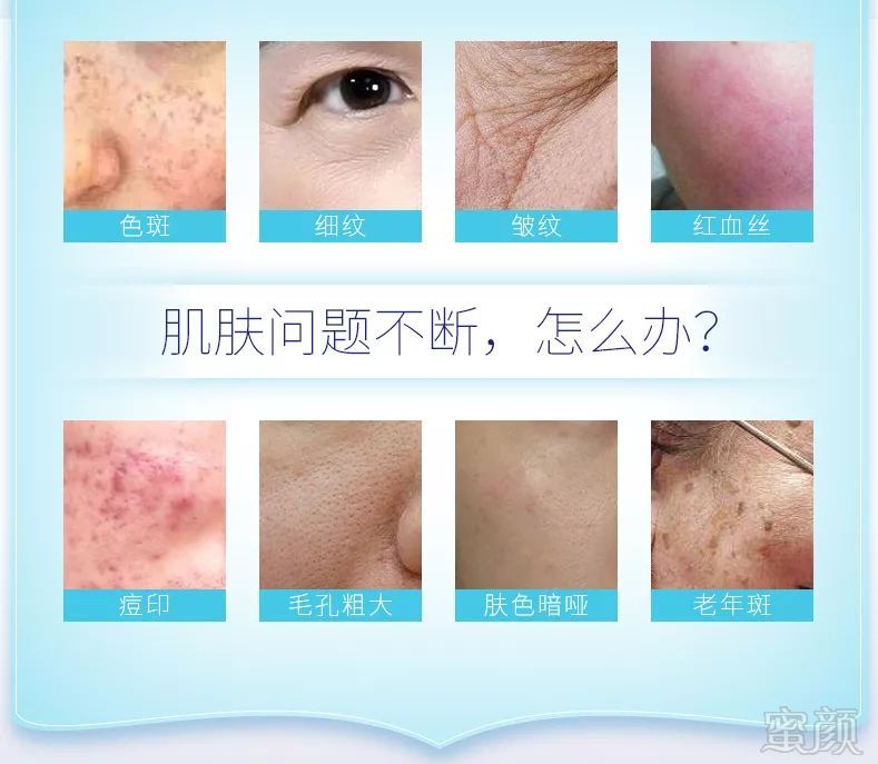 https://img.miyanlife.com/mnt/timg/180920/1105256493-1.jpg
