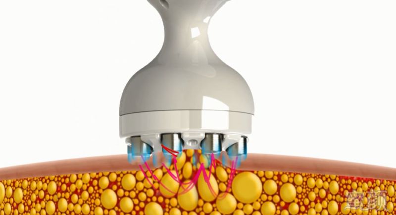 https://img.miyanlife.com/mnt/timg/180920/110525EZ-5.jpg