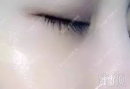 https://img.miyanlife.com/mnt/timg/180920/11062S414-5.jpg