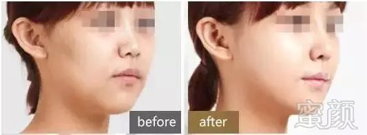 https://img.miyanlife.com/mnt/timg/180921/112H62596-7.jpg