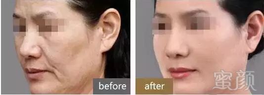 https://img.miyanlife.com/mnt/timg/180921/112H62Z6-8.jpg