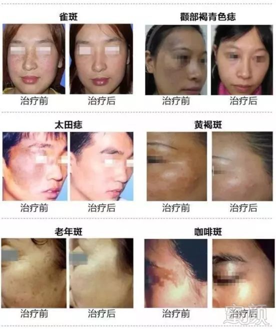 https://img.miyanlife.com/mnt/timg/180921/112H64308-6.jpg