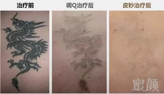 https://img.miyanlife.com/mnt/timg/180921/112HA0E-10.jpg