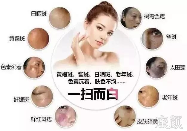 https://img.miyanlife.com/mnt/timg/180921/112HB207-5.jpg