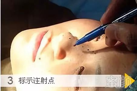 https://img.miyanlife.com/mnt/timg/180921/113IGQ1-6.jpg